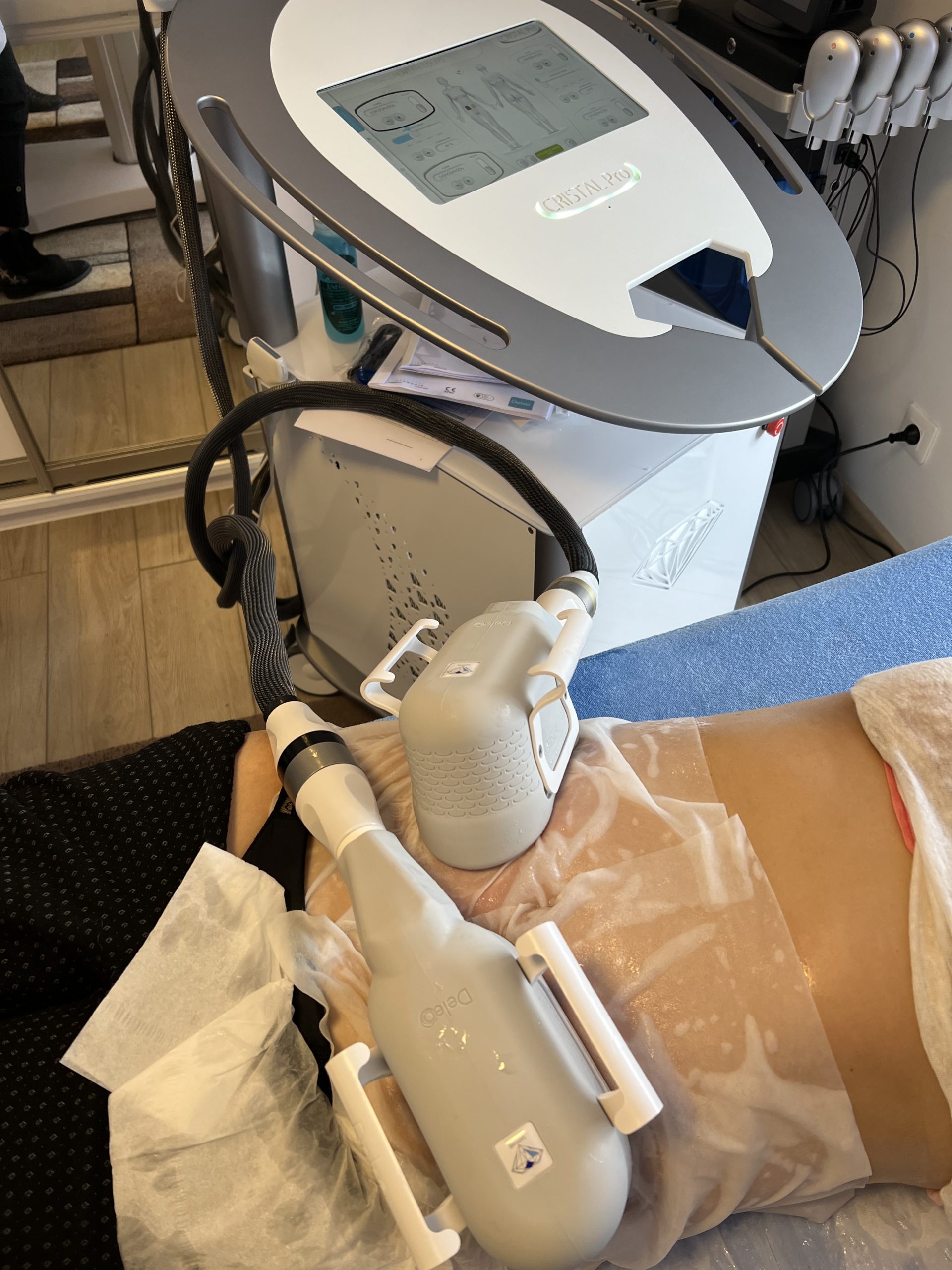 cryolipolyse centre laser du parc wattignies docteur hima bentein