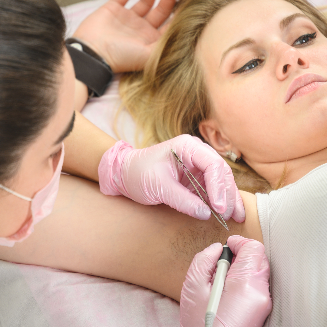 epilation laser définitive centre laser du parc wattignies docteur hima bentein